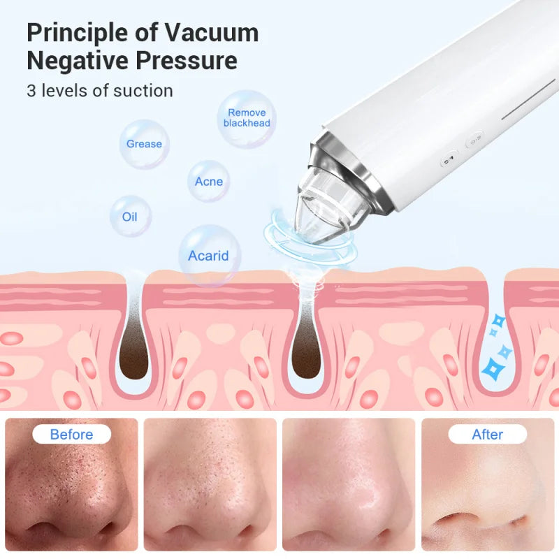 Visual Pore Cleaning With Camera