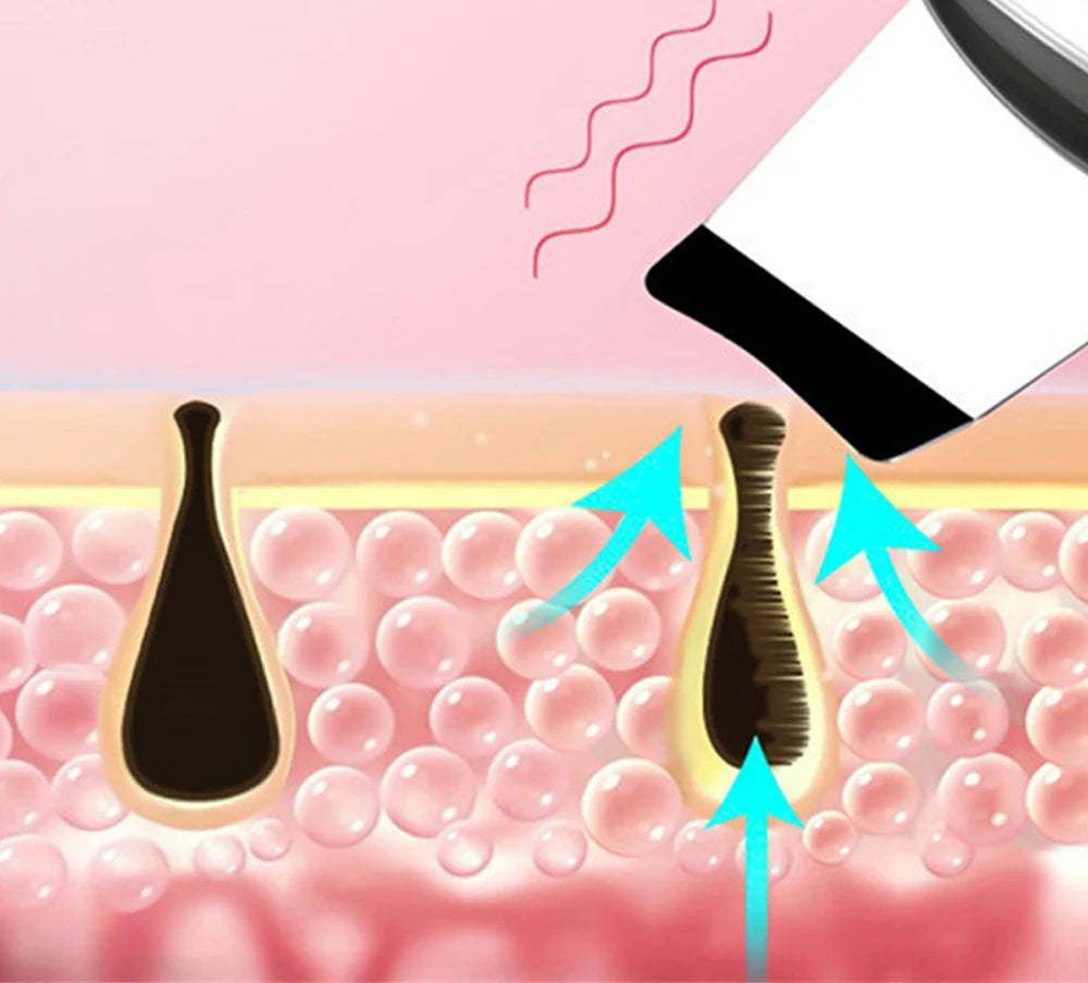 Ultrasonic Facial Cleansing Scrubber