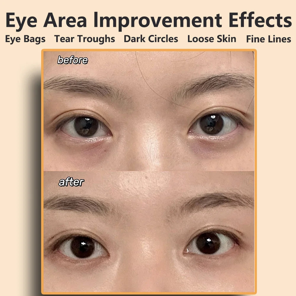 Ems Eye Face Beauty Massage